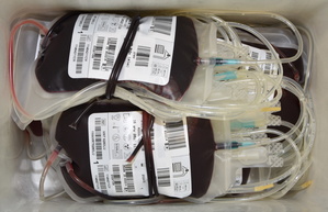 „NASZA KREW - NASZA OJCZYZN”. Akcja honorowego krwiodawstwa w OSS SG w Lubaniu
